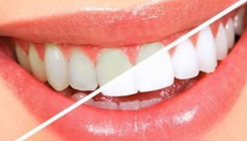 3DEEP黃金微針射頻美膚：揭秘深圳蓉悅姜中蓉的煥膚攻略