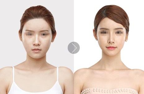 重慶聯(lián)合麗格整形實力解析：雙眼皮、隆鼻、隆胸技術(shù)優(yōu)異，收費透明