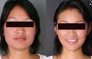 大連市熱門(mén)整形美容醫(yī)院排行榜