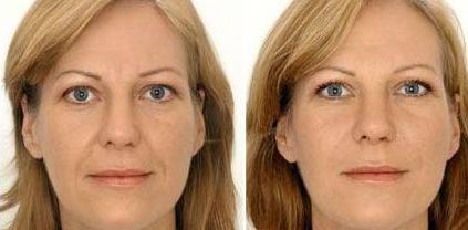 寧波整形美容院推薦TOP8，評測結果公布！