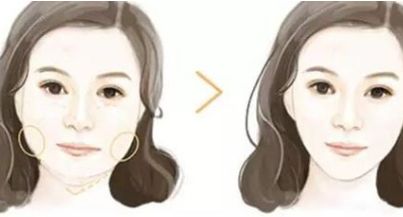 西安藝星隆胸術(shù)口碑評(píng)價(jià)