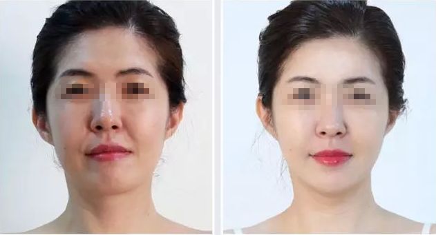 濟寧哪家整形醫(yī)院評價好，口碑排名靠前的有哪些？