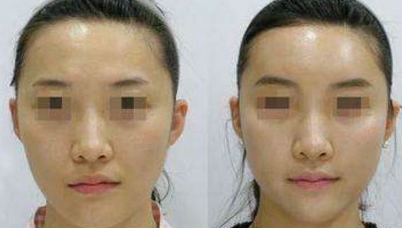 上海拉皮手術推薦排名揭曉！8位知名專家評選完整名單！