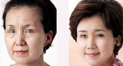 珠海整形醫(yī)院哪家好？排名榜前五都有哪些醫(yī)院？