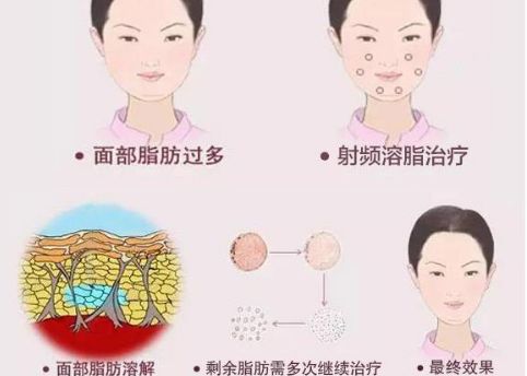 徐州二院整形美容科專家評(píng)價(jià)及服務(wù)項(xiàng)目介紹，陶常波醫(yī)生特長(zhǎng)領(lǐng)域一覽