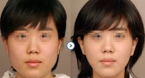 【揭秘】合肥私立整形醫(yī)院人氣TOP榜單！