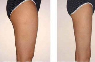 上海伊妍仕少女針機(jī)構(gòu)認(rèn)證排行榜！前五前八可信賴！