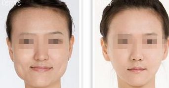 黑龍江三甲整形醫(yī)院熱門(mén)榜單，前三強(qiáng)大揭秘！