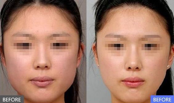 成都整形美容醫(yī)院綜合排行榜Top10出爐！這些醫(yī)院受歡迎程度堪比明星哦！