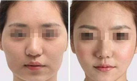 武漢熙蒙整形醫(yī)院信譽(yù)如何醫(yī)生介紹、費(fèi)用更新了！