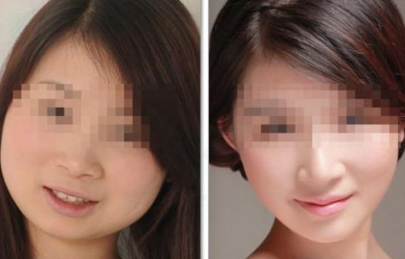 洛陽(yáng)哪家醫(yī)學(xué)美容院眉部整形技術(shù)頂尖