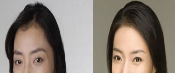 西安市優(yōu)質(zhì)整形醫(yī)院排行榜前5強(qiáng)