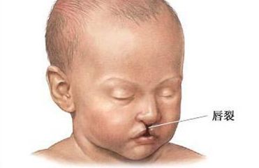 最新盤點：沈陽隆胸整形醫(yī)院大排行，人氣醫(yī)生與價格揭秘