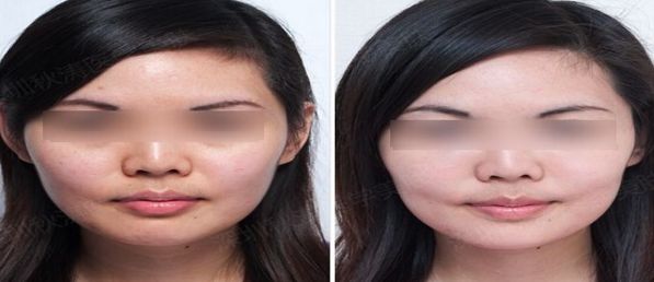 北京醫(yī)美行業(yè)領(lǐng)先者揭曉，排名前十大公示