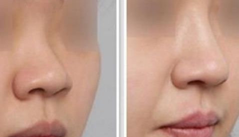 沈陽杏林醫(yī)院官網(wǎng)詳解領(lǐng)先技術(shù)，臉部果展示讓你重獲自信