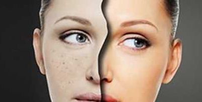 盤點(diǎn)2024年武漢哪家醫(yī)院能夠進(jìn)行自體脂肪填充術(shù)