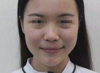 南充疤痕整形醫(yī)院排名精選，助你尋找完美去疤痕之旅