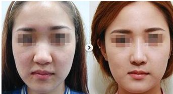 西安疤痕修復醫(yī)院口碑榜單，這4家實力出眾