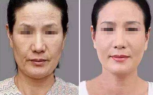 2024年連云港整形醫(yī)院專業(yè)排行榜出爐，你知道嗎？