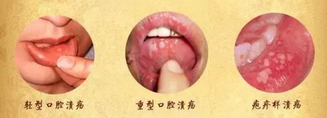 北京眼袋整形醫(yī)院排名大揭秘，最佳去眼袋選擇！