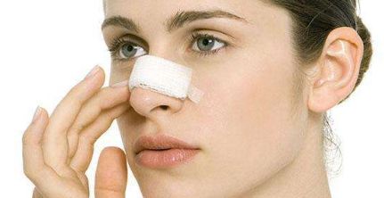 找醫(yī)生修復(fù)雙眼皮，怎樣找到醫(yī)生王莉莉的優(yōu)秀案例？