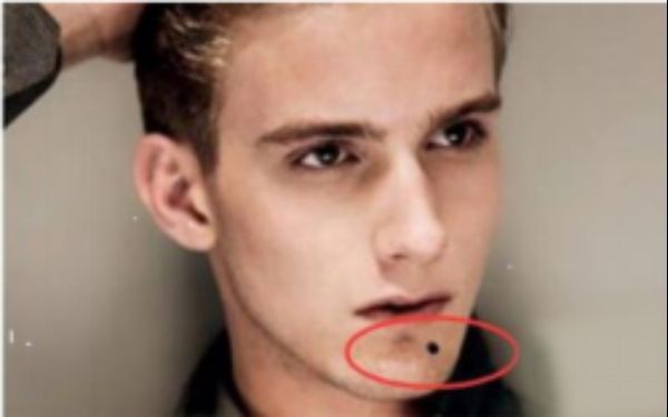 北海市人民醫(yī)院整形科眼袋手術(shù)效果如何？技術(shù)實(shí)力與真實(shí)案例揭秘