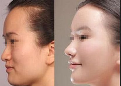 臨沂市醫(yī)美醫(yī)院排名及推薦，推薦你去哪家治療效果好