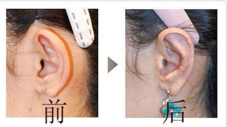 成都友誼醫(yī)院疤痕科：設(shè)備先進(jìn)、技術(shù)精湛，治療效果如何？