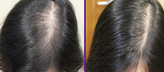 杭州綜合整形醫(yī)療界的翹楚，實至名歸，來挖掘一下吧！