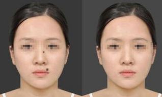 2024年重慶雙眼皮手術(shù)醫(yī)院排行榜前十，告訴你如何選擇最佳醫(yī)院