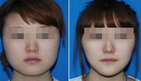 2024青島頗受好評的抽脂整形醫(yī)院推薦TOP4