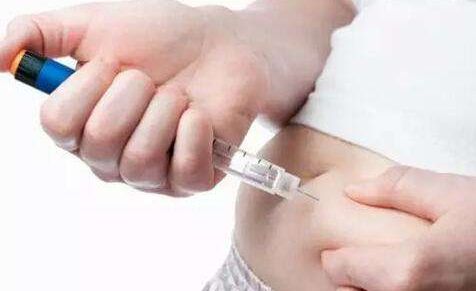 南京推薦雙眼皮手術(shù)好的頂級(jí)醫(yī)院是哪家