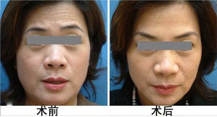 常州哪家唇部整形醫(yī)院值得信賴，價(jià)格如何？