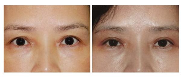 廣州整形醫(yī)院排名：領銜藝美、威利斯、美涵！