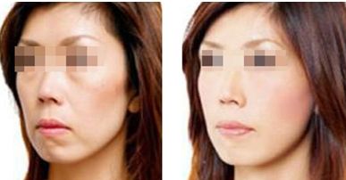 【2024年】北京治療疤痕的權(quán)威醫(yī)院TOP3推薦