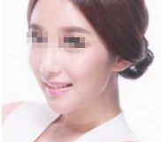 2024年太原頂級整形醫(yī)院排名曝光，專家評選出的前10強(qiáng)！