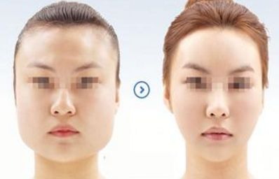 2024年溫州哪家醫(yī)院的整形美容效果最佳？