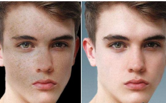 深圳哪里可以有效改善額頭問題，專業(yè)治療推薦