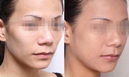 平頂山市激光去斑排行榜：哪家美容醫(yī)院效果好