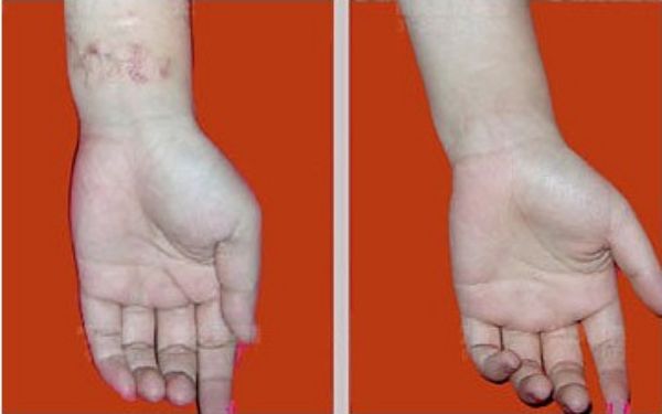 【雙眼皮專家駕到！武漢中翰整形醫(yī)院付毅院長親診雕刻美眼】