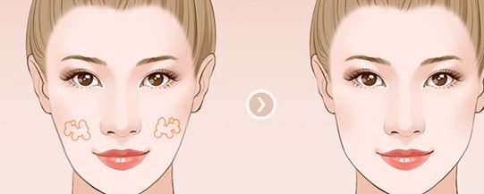 濟南整形醫(yī)院推薦：權(quán)威醫(yī)院排名及口碑比較