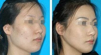 上海優(yōu)質(zhì)美容醫(yī)院盛行，曙光醫(yī)院和長海醫(yī)院卓越實力受矚目！速來查看！