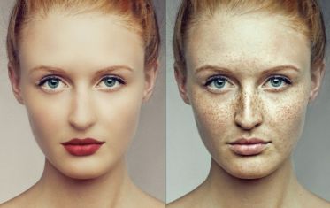 昆明三甲醫(yī)院激光美容推薦TOP5，解析裝修比較好的臨床醫(yī)生一線分享