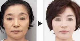 西安哪家醫(yī)院擅長(zhǎng)面部輪廓整形？