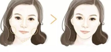 大連市哪些醫(yī)院是專業(yè)的開眼角整形中心？