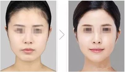 武漢治療色斑好的醫(yī)院推薦，哪家效果好呢？