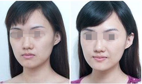 湖州唯美醫(yī)療美容門診部大眾口碑如何