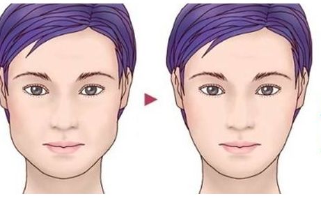 上海佳詩美醫(yī)療好不好？絕美雙眸案例及價(jià)格公開收集