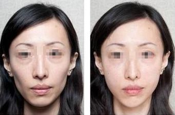 上海五家整形醫(yī)院盤(pán)點(diǎn)