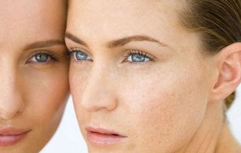 濟(jì)南哪家醫(yī)院做雙眼皮效果好